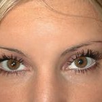 20100125_botox