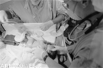Anomalia del cordone ombelicale, neonato muore durante il parto