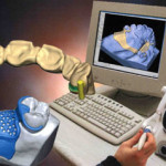 20100623_protesi_odontotecnici_cadcam