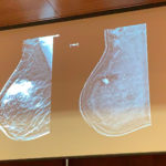 donazione_mammografo_calcit_06