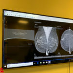 donazione_mammografo_calcit_17