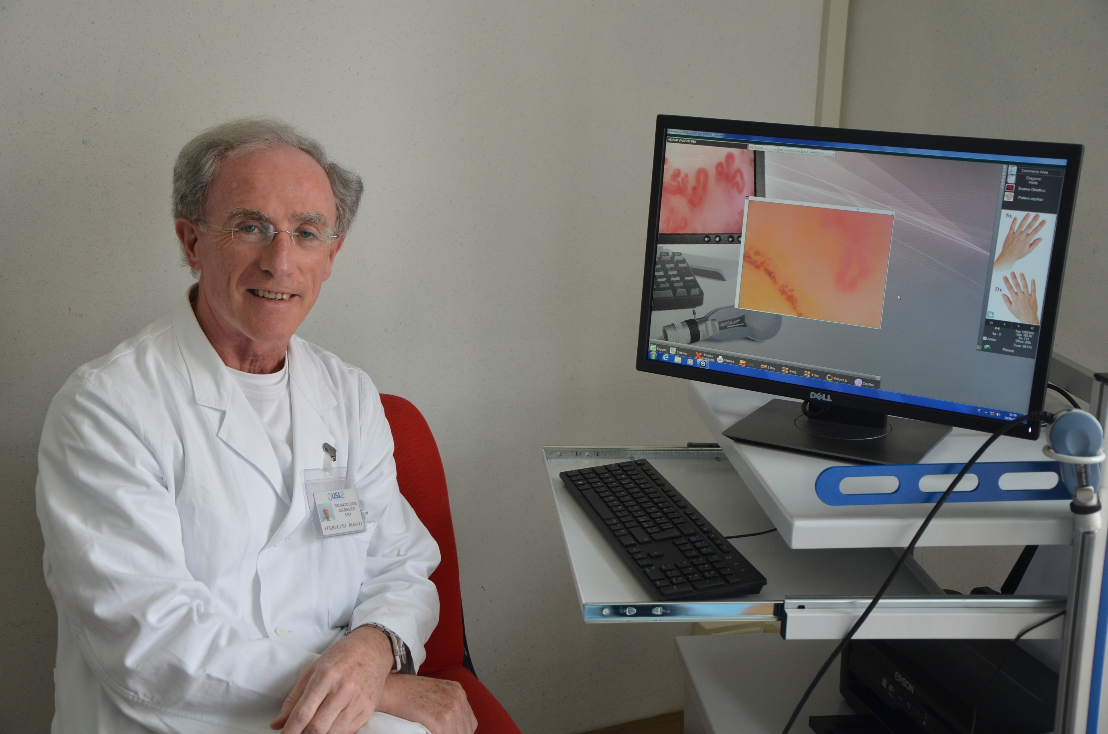 Sclerodermia, al S. Donato c’è una rete di specialisti