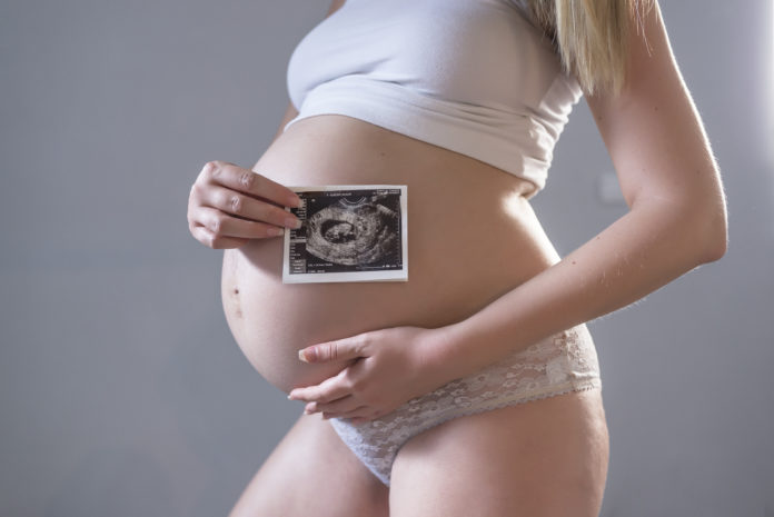 pregnant woman holding an x-ray in front of her belly high