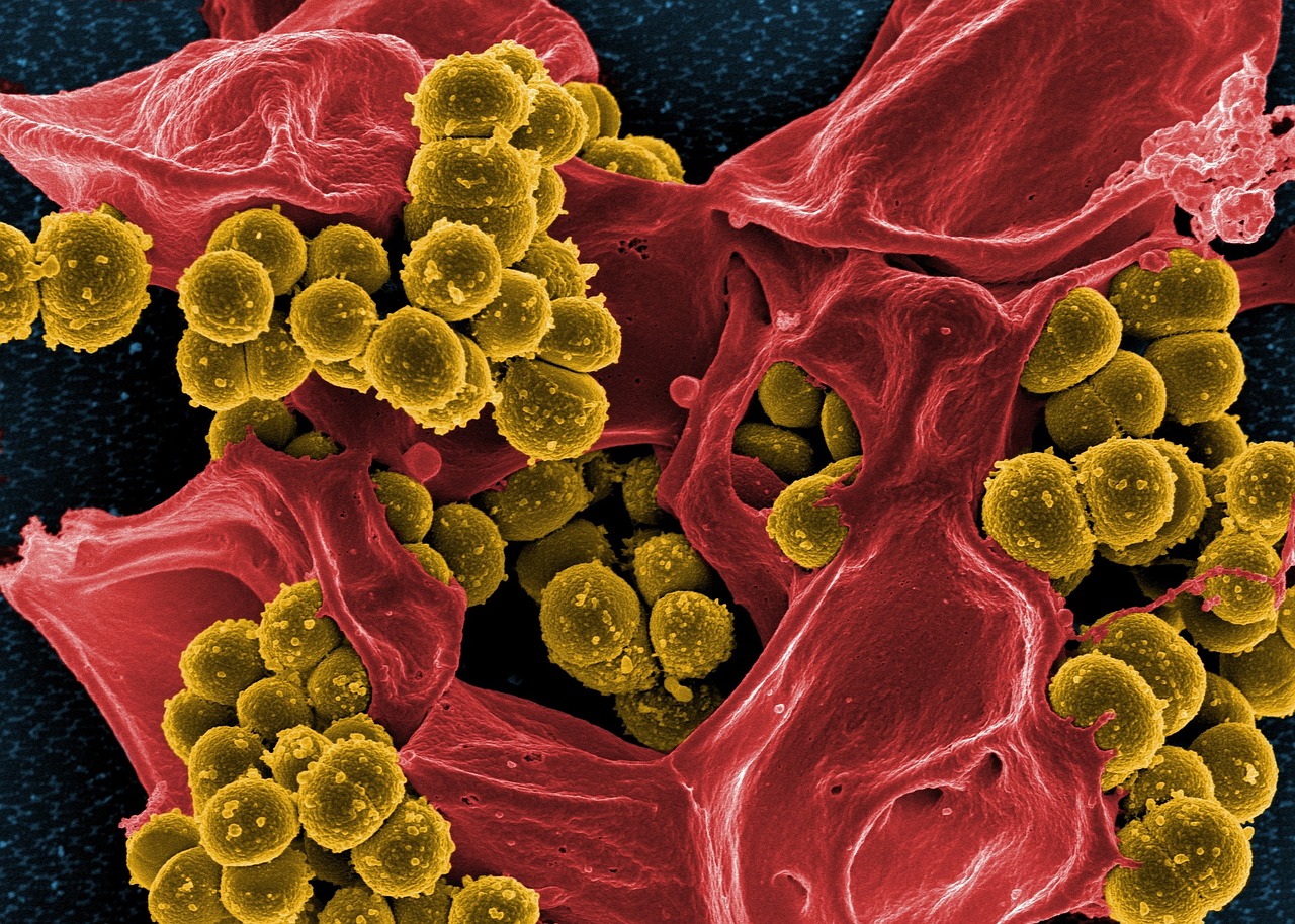 Istituto superiore di sanità: New Dehli ampio fenomeno epidemico