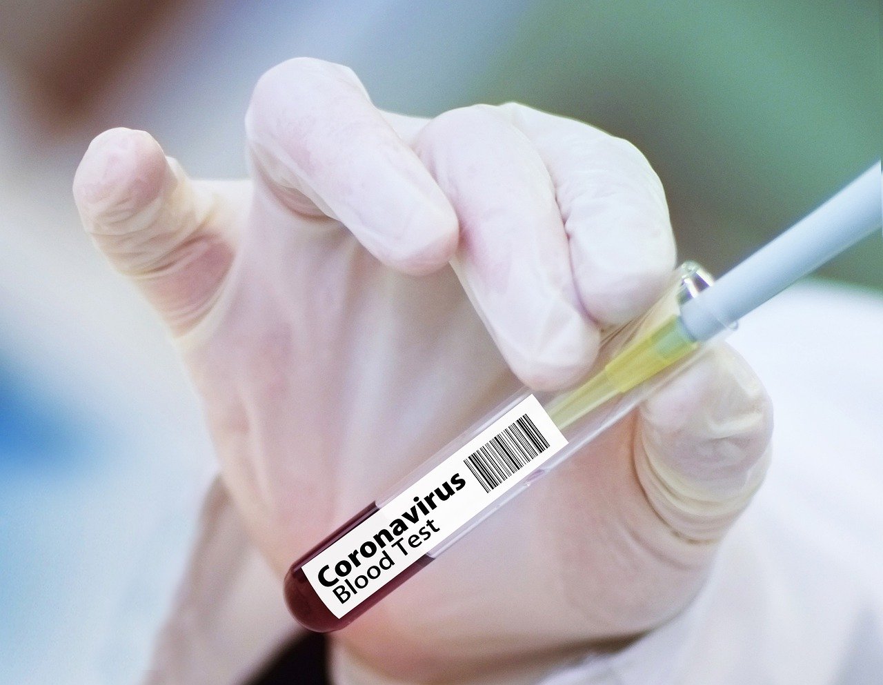 Coronavirus, in Toscana 84 nuovi casi e nessun decesso. 22 i guariti