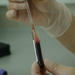 coronavirus covid sangue esami