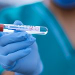 covid-19-coronavirus-laboratorio-infermiere