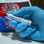 covid-19-coronavirus-laboratorio-infermiere-test-postitivo