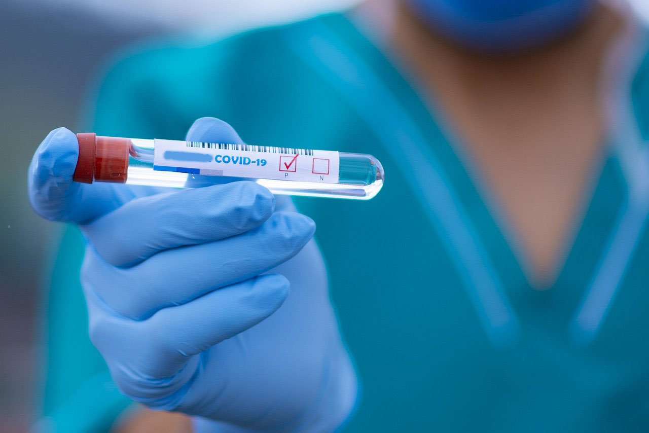 Coronavirus: in Toscana 21 nuovi casi, 1 decesso, stabili le guarigioni