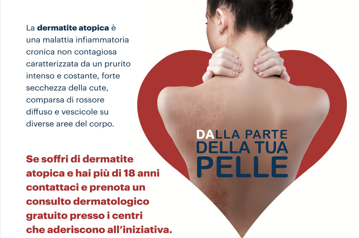 Dermatite atopica dell’adulto: il 26 settembre consulti dermatologici gratuiti ad arezzo