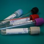 provette-esami-coronavirus