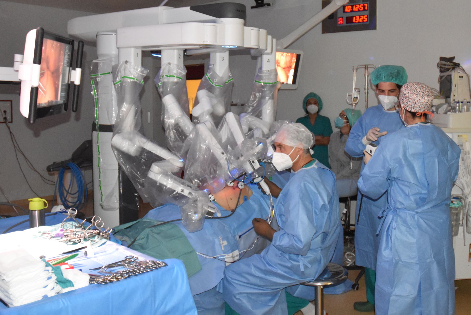 San Donato: asportazione della metà sinistra fegato con la chirurgia robotica