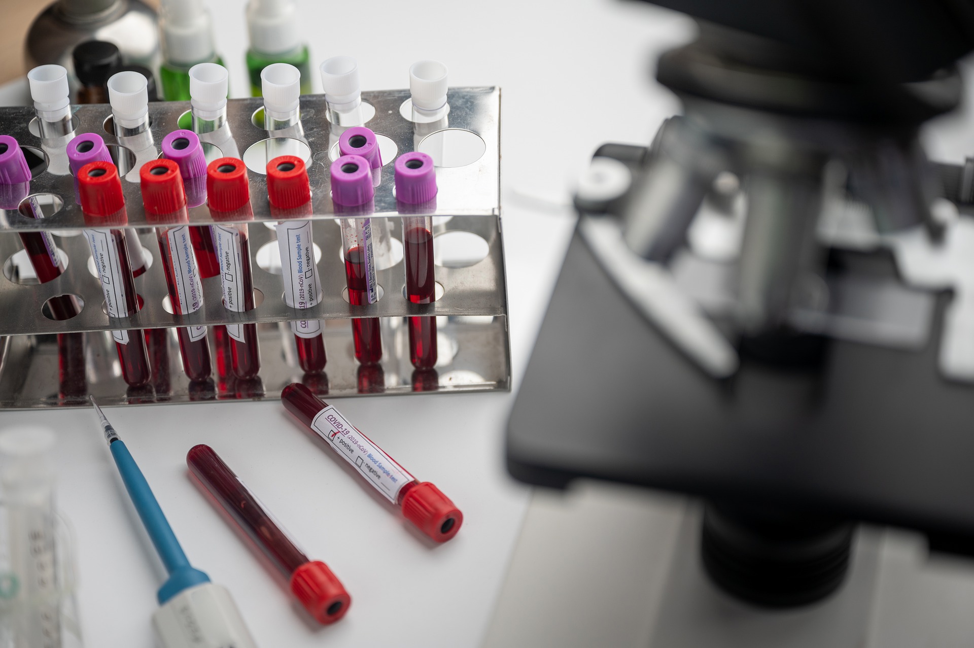 Coronavirus: 34 nuovi casi nell’aretino, 10 persone in degenza covid e 1 in terapia intensiva Coronavirus: 34 nuovi casi nell’aretino, 10 persone in degenza covid e 1 in terapia intensiva