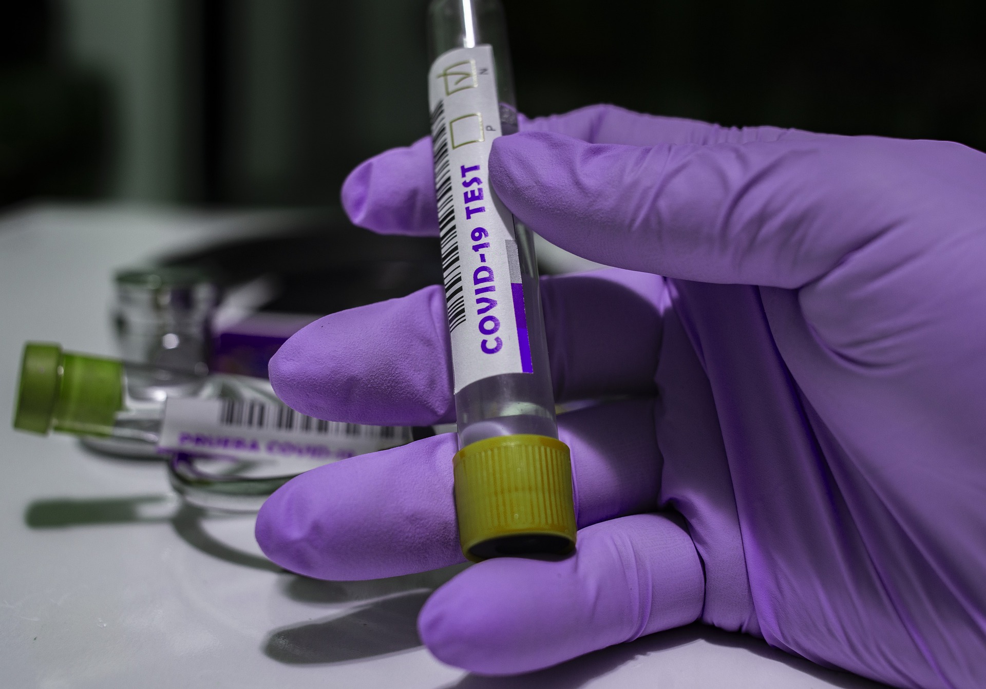 Coronavirus: 399 nuovi casi nell’aretino, 16 persona in degenza covid, 2 persone in terapia intensiva