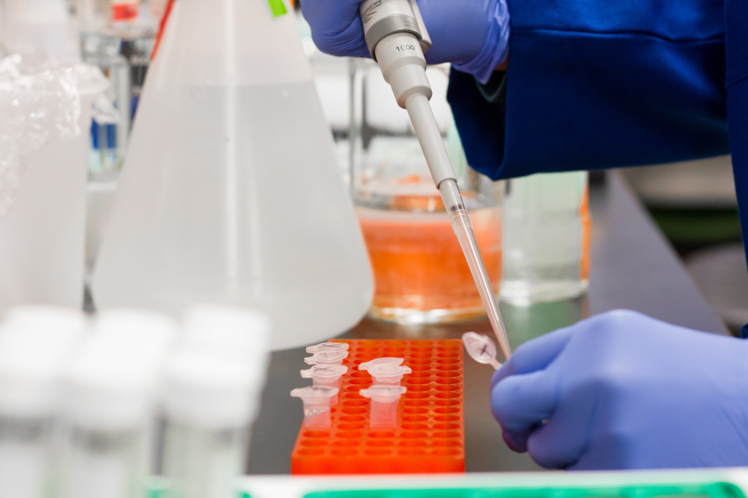 Coronavirus: 581 nuovi casi nell’aretino, 35 persone in degenza covid, 4 in terapia intensiva Coronavirus: 581 nuovi casi nell’aretino, 35 persone in degenza covid, 4 in terapia intensiva