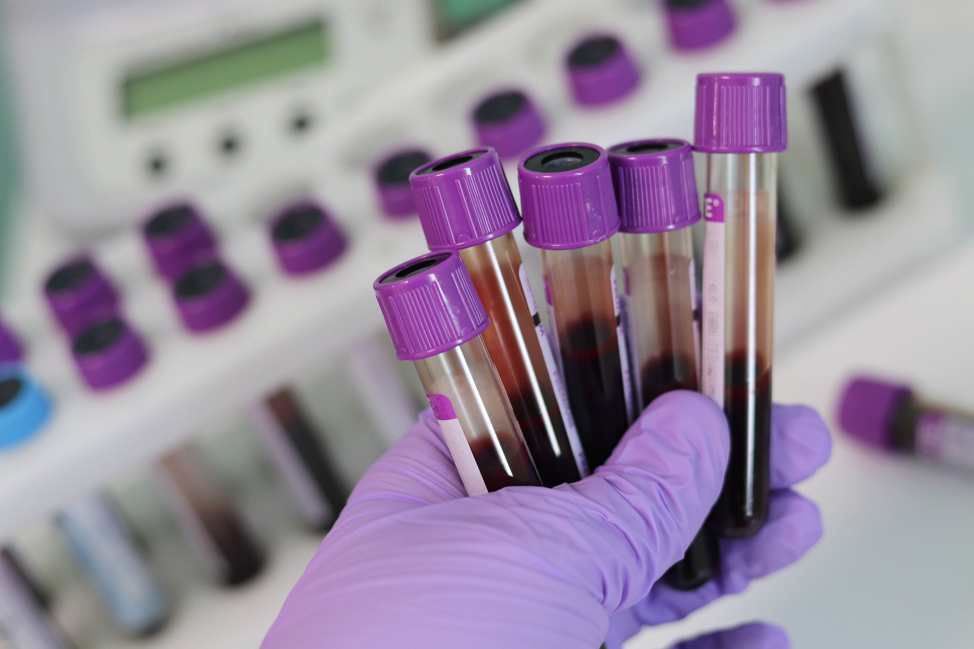 Materiali estranei in campioni di sangue dei vaccinati con farmaci mRNA