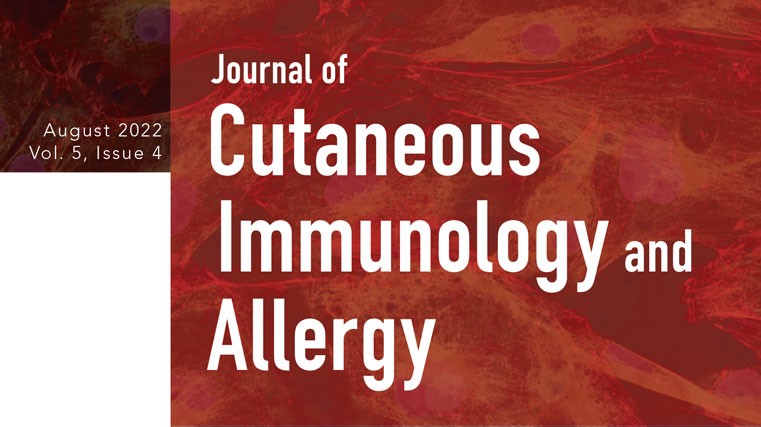 Journal of Cutaneous Immunology and Allergy: c’è correlazione tra vaccinazione Covid-19 e Herpes Zoster?